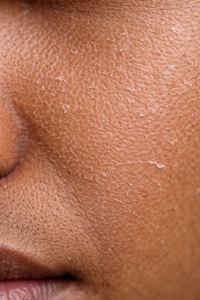 Sensitive & Dry Skin